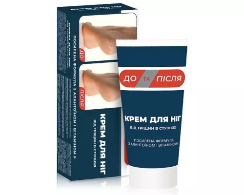 До та Після, крем для ніг, 150 мл | интернет-аптека Farmaco.ua